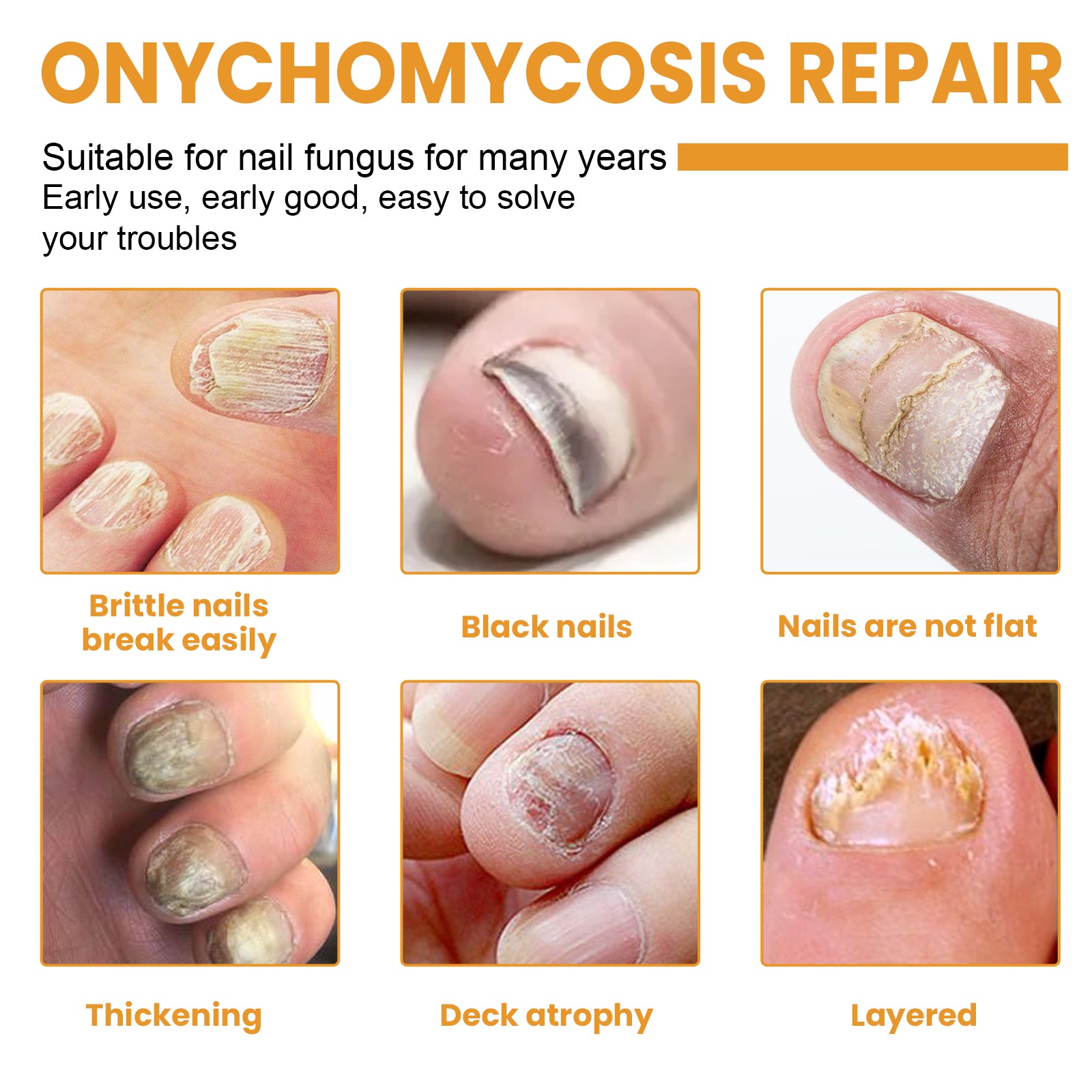 Fungal Nail Patches, Repair Nail Thickening Grey Nail Soft Nail Shine Nail Care Patch