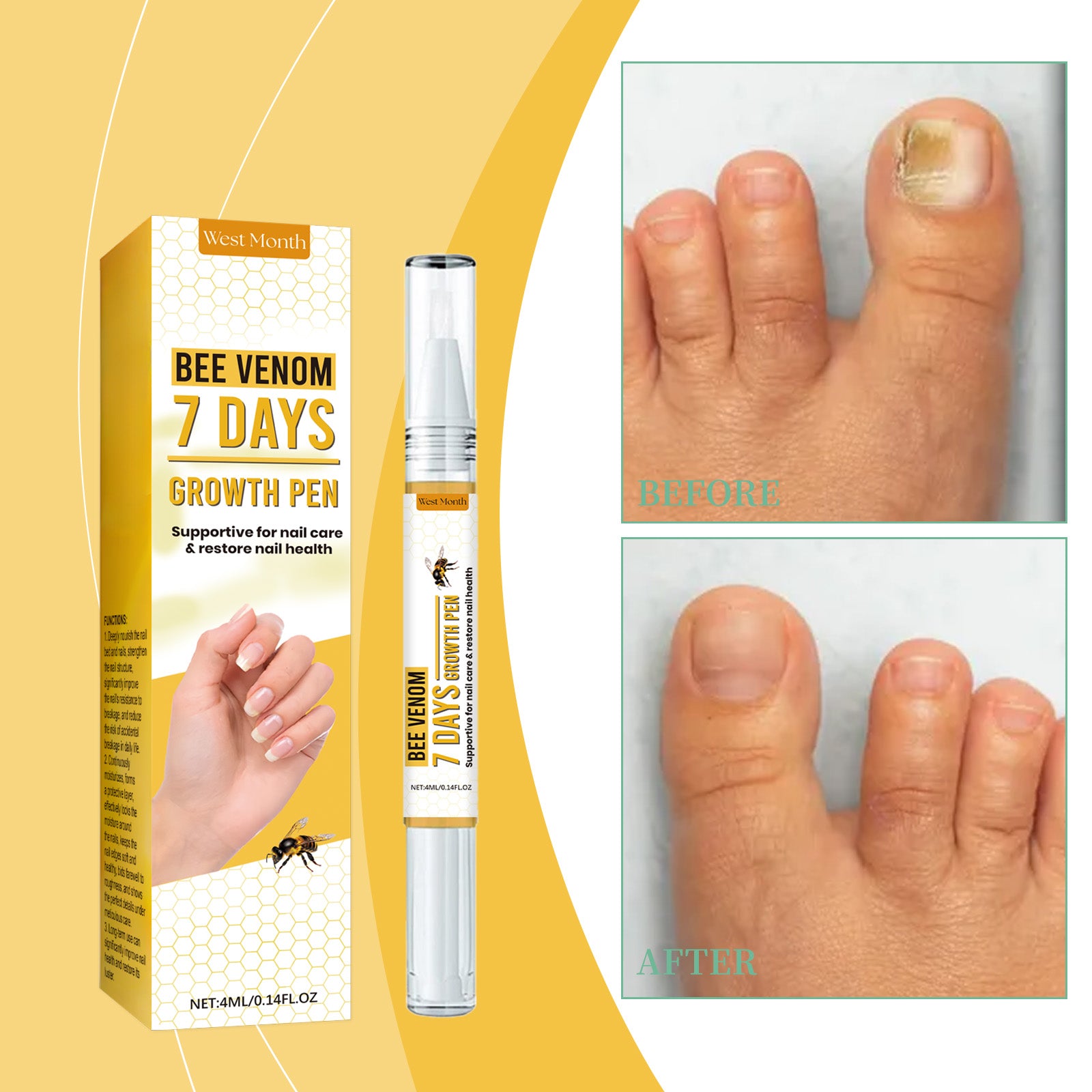 West&Month Nail Repair Solution, Hand And Foot Nail Cleaning Care Gentle Moisturizing And Moisturizing Nail Repair Solution